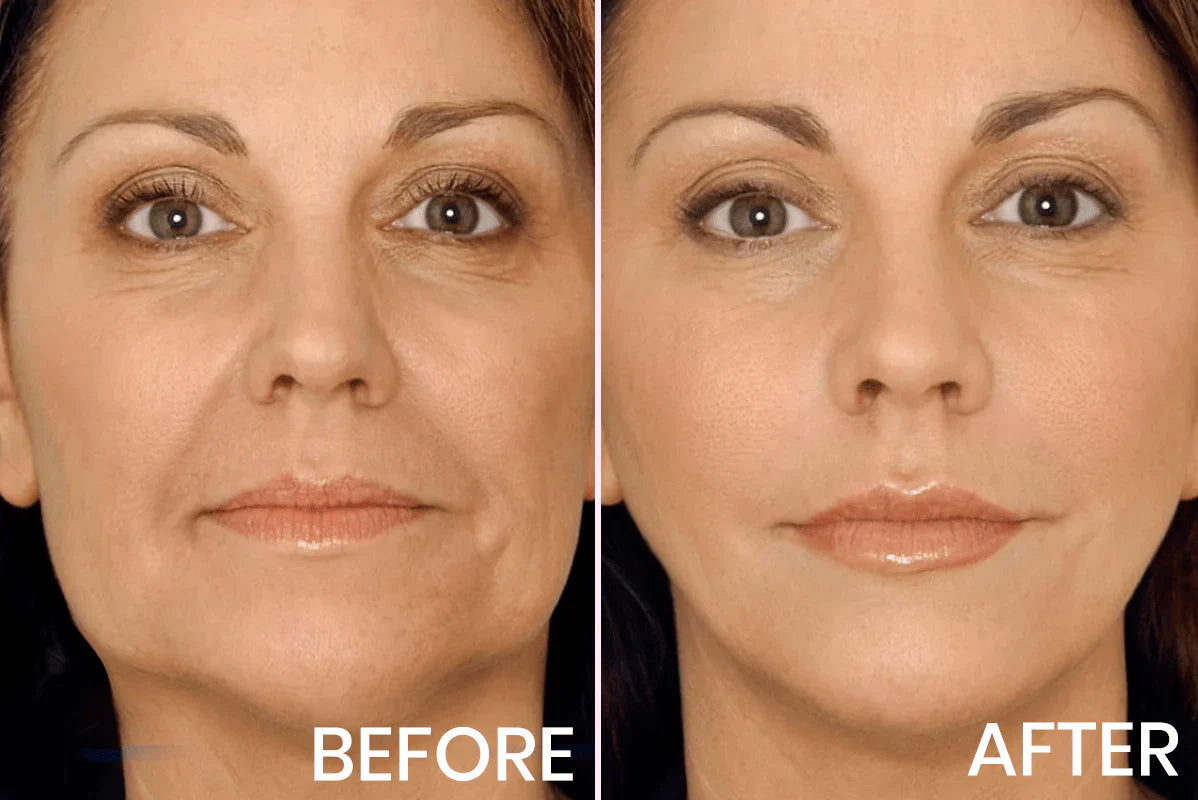Advanced Firming & Wrinkle-Reducing Cream | Buy 1 Get 1 Freeš„