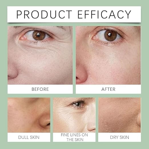 Advanced Firming & Wrinkle-Reducing Cream | Buy 1 Get 1 Freeš„