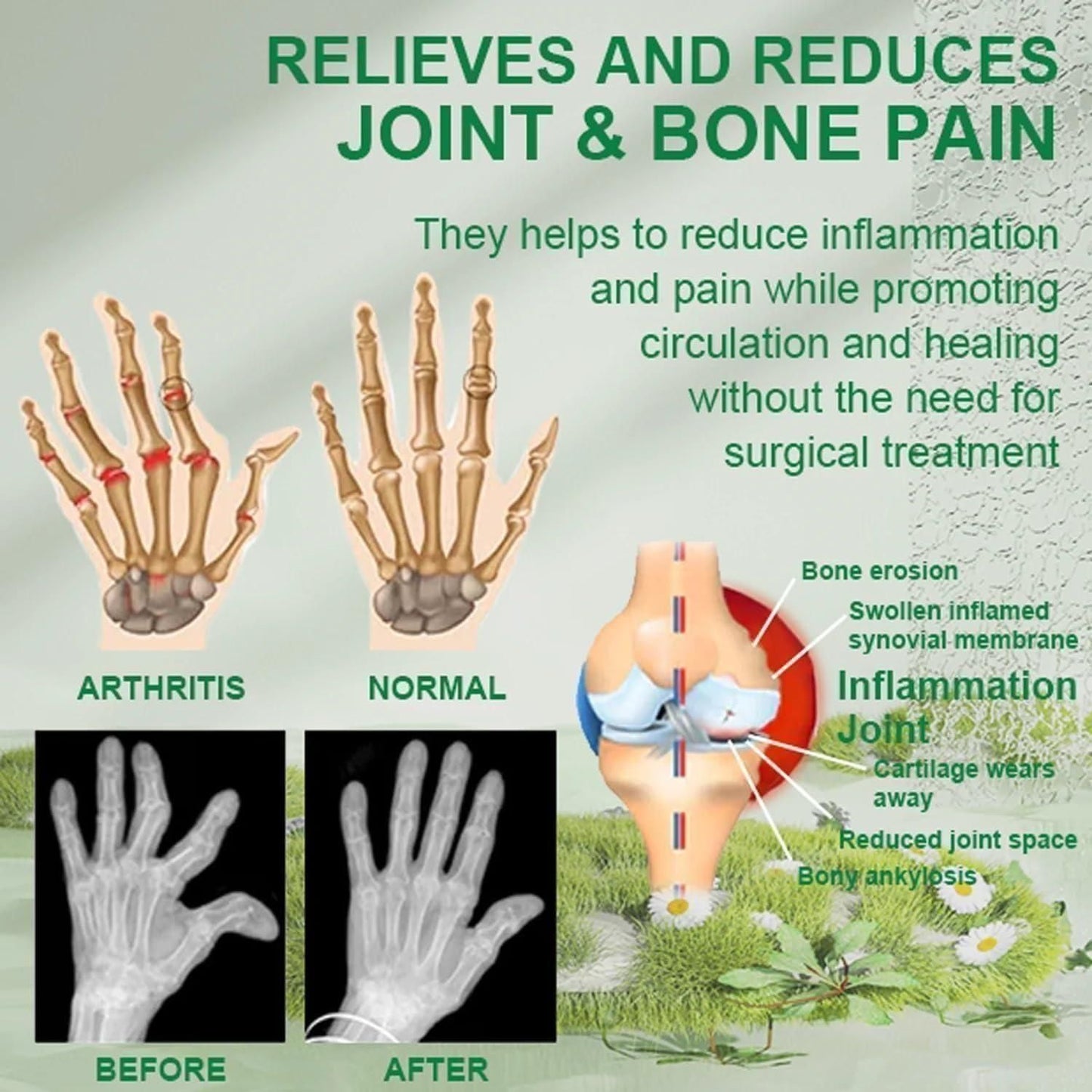 BeeTherapy™ #1 Bee Venom Pain Relief Cream (Buy 1 Get 2 Free 🔥)