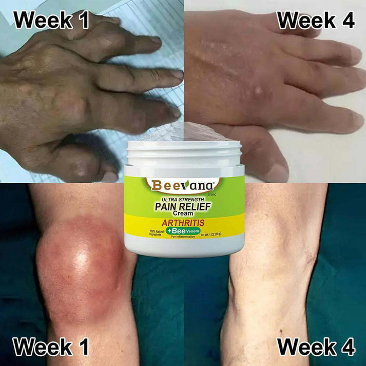 BeeTherapy™ #1 Bee Venom Pain Relief Cream (Buy 1 Get 2 Free 🔥)