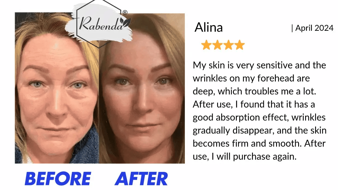 Advanced Firming & Wrinkle-Reducing Cream | Buy 1 Get 1 Freeš„