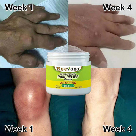 BeeTherapy™ #1 Bee Venom Pain Relief Cream (Buy 1 Get 2 Free 🔥)