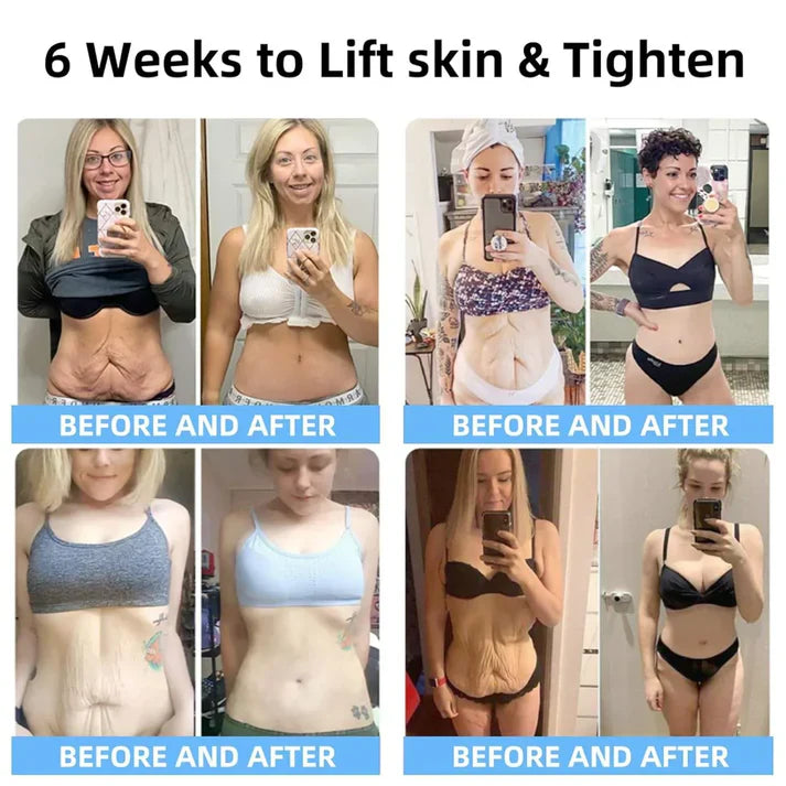 Advanced Firming & Wrinkle-Reducing Cream | Buy 1 Get 1 Free🔥