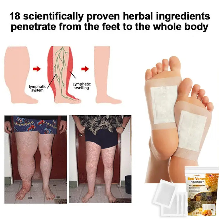 Bee Venom Lymphatic Drainage & Slimming Foot Patches (Pack of 10)🌿👣
